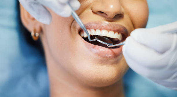 Best Emergency Dental Care for Sports Injuries in Fairport Harbor, OH